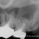 연세리버힐치과의원 이미지