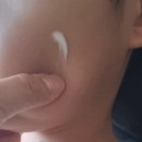 리프테라피