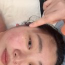 평화순환길 | 스킨 진주사천점' 미네랄아쿠아스파 2단계 관리 받은 후기, 예민홍조피부/붓기관리/ 수분순환테라피 추천