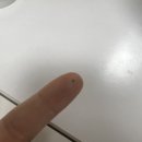 759 | 깨순이의 주근깨 터는 날 / 압구정 피부과 루비레이저 내돈내산 주근깨 시술 후기 / 759방 / 당일~ 1주