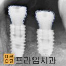 경주치과기공소 이미지