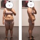 씨에프(CF)의원 | 고도비만도 가능한 전신다이어트주사로 소문난 강남비만클리닉<CF클리닉 (씨에프클리닉)>
