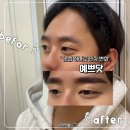 그리너리프라이빗뷰티샵 | 방이역 반영구 눈썹 관리 예쁘닷 프라이빗 뷰티샵 방문 후기