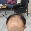 김호증모가발다온헤어