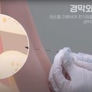 에스엠퓨어텍 네이버블로그