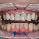 바른손치과기공소 이미지