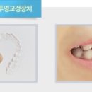 앞선치과기공소 이미지