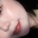 베이스피부과의원 | [노원] 노원피부과 추천 속건조 종결 물광피부 필로드 예쁨주의쁨의원 노원 쁨클리닉 내돈내산 솔직후기