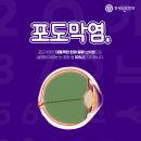 부천연세안과의원 이미지