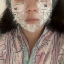 리을2 | 리을피부과(구 스위츠피부과) 울쎄라 400샷 시술후기