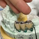 M치과기공소 이미지