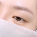 아인메디칼 | 구월동눈썹문신 쌍수 대신 남친이 준 선물