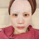 분당 스킨부스터 알에프포샵(RF4#) 인모드포마 고주파관리 찐~후기
