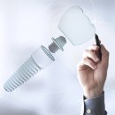 미래치과기공소 이미지