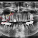 의정부본플란트치과의원 이미지