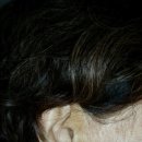 귀에조은보청기 이미지