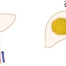 아시아방사선 이미지