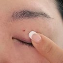 채희재피부과의원 이미지