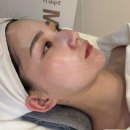 다달뷰티 | 강남피부관리 웨딩케어 보습 재생 후기 (LDM 트리플 + 빙하수 쿨링팩 + 산소젯 + LED 광선 케어) 삐땅기...