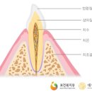 미백치약 효과있나??? 이미지