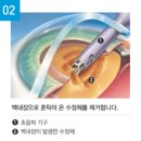 광주안과의원 이미지