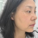 다인로얄팰리스배곧5차(배곧로얄팰리스5차) | 배곧 과학적인 피부관리 썸뷰티끄 뷰티샵 l ESV10 모공수분관리 EMS 순환관리 후기