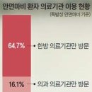 안면마비,뇌질환신호일수도 이미지