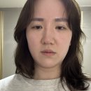 타겟링크 | 청담피부과 추천! 리프팅 시술 (볼링크4D) 내돈내산 후기 - 36살에도 귀여워질 수 있을까?