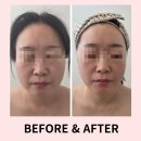 라피움 | 다사피부관리 라피움은 뱀부윤곽관리 후기가 믿을만한데요?