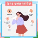 4월 26일(토) 봄철 &#39;근질근질&#39; 불청객 꽃가루 알레르기, 주범 있다 이미지