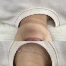 삐삐슈퍼 | [부산] 센텀 피부관리 ‘센텀삐삐래쉬&amp;스킨’ 이중턱관리 후기