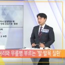 한국경제TV 건강매거진(발, 발목질환) 메드렉스병원 양혁재 병원장님 출연 이미지