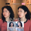 피부명가 | 수원 피부관리 추천, 인계동 &#39;약손명가&#39; 전후 차이 솔직 후기