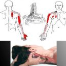 서울시원한마취통증의학과의원 | 안양도수치료TIP, 목디스크 후기 팔이 저린 이유? 16년차는 '신경의 가동성'에 주목합니다