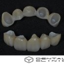 동의치과기공소 이미지