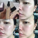 나우앤포에버 | 후기 - 프로레나타 나우 앤 포에버 리페어 엑티베이트