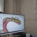 이미지 치과기공소 이미지