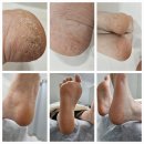 제이플래닝 | 청주 로라제이 패디플래닝 관리 솔직 후기｜발 관리 제대로 받고 왔어요😊