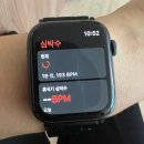 발작성 상심실성 빈맥 PSVT 전극도자절제술 시술 후기 신촌세브란스병원
