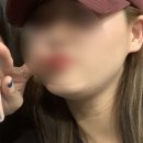 덴탈라인 | 서울 이중턱 지방흡입 내돈내산 솔직후기 (이중턱지방흡입, 볼지방흡입, 근육묶기)