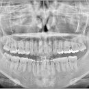 나은치과기공소 이미지
