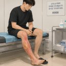 한사랑외과의원 | [이천 화상]화상 다 낫는 데 얼마나 걸리나요?