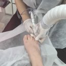 독일식문제성손발관리전문점푸스플레게장연자 | 위브페디 베어푸스플레게 문제성 발톱 케어 방문 후기 (동대문파고드는발톱 청량리문제성발톱 청량리발...