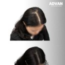 어드반SMP 이미지