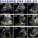 상복부 급여 이미지