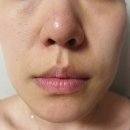 나원기획 | 메디필엑스트라슈퍼9플러스3X피지연화제 - 올리브영피지클리너 기획세트, 피지연화제 추천!