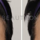 뷰티온의원평택고덕점 이미지