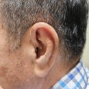 경중 | 주성동보청기 경중도 난청 전용 보청기 착용 후기