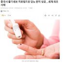 [속보] 중국 미쳤다!! 줄기세포 치료법으로 당뇨 완치 성공 ㅎㄷㄷ 세계 최초란다 이미지