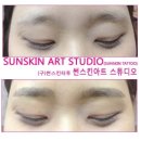 썬스킨